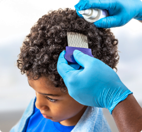Professional Head Lice Removal Treatment Img 1