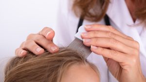 How Long Is Head Lice Actually Contagious?