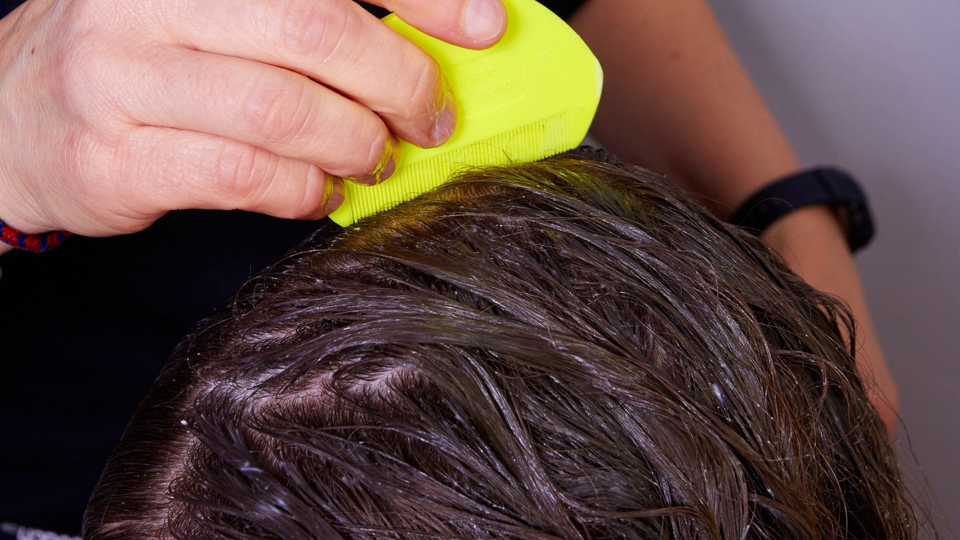 How Do You Spot Lice And Nits In Brown Hair?