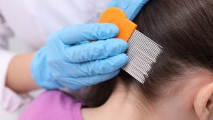 How Do You Use A Lice Comb To Remove Every Nit? featured image