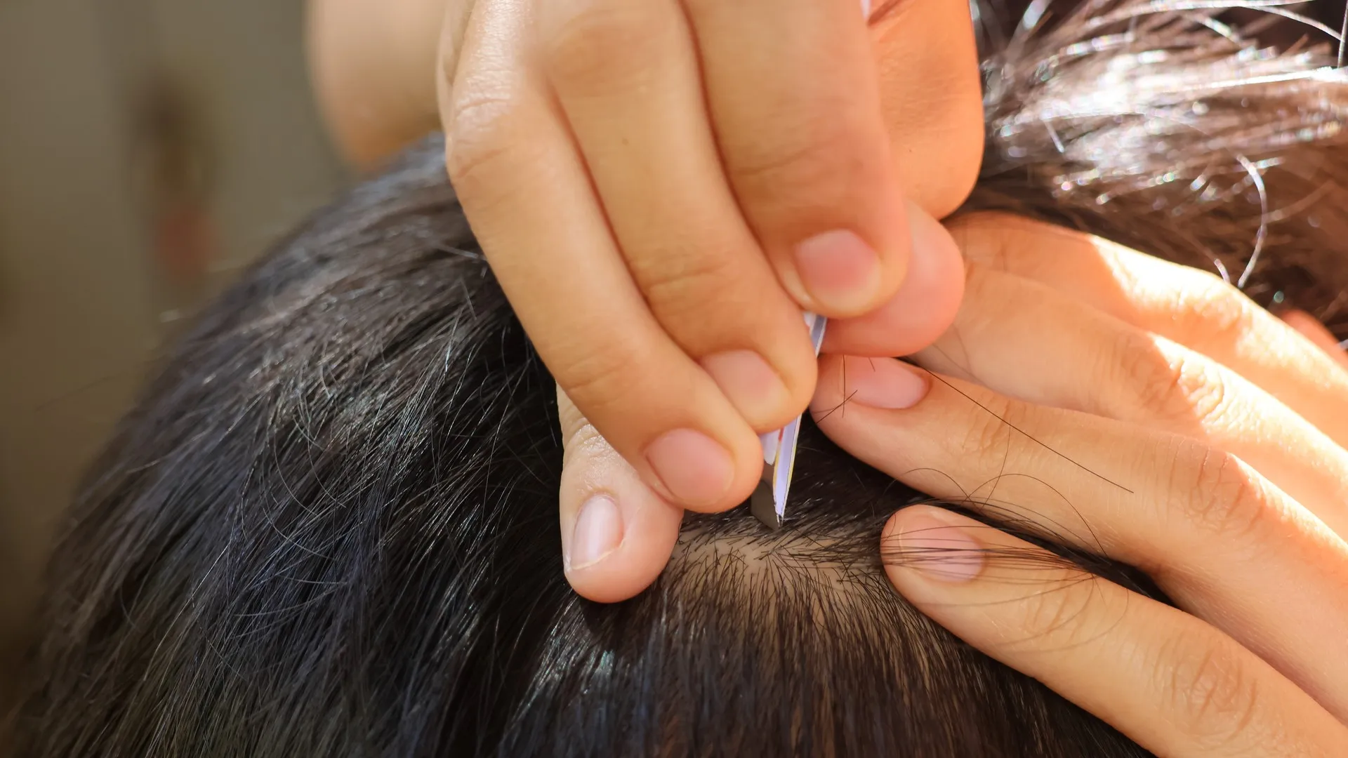 Hands carefully removing a louse from dark hair with tweezers