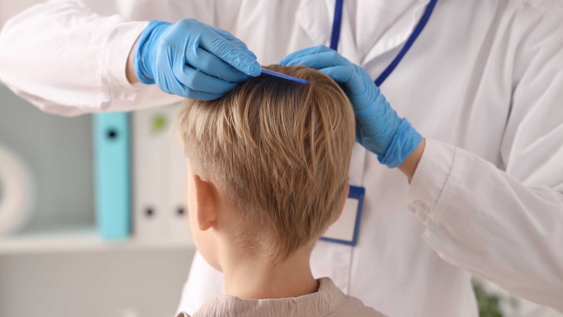 Upgraded: Head Lice Are Almost Never Actually Black
