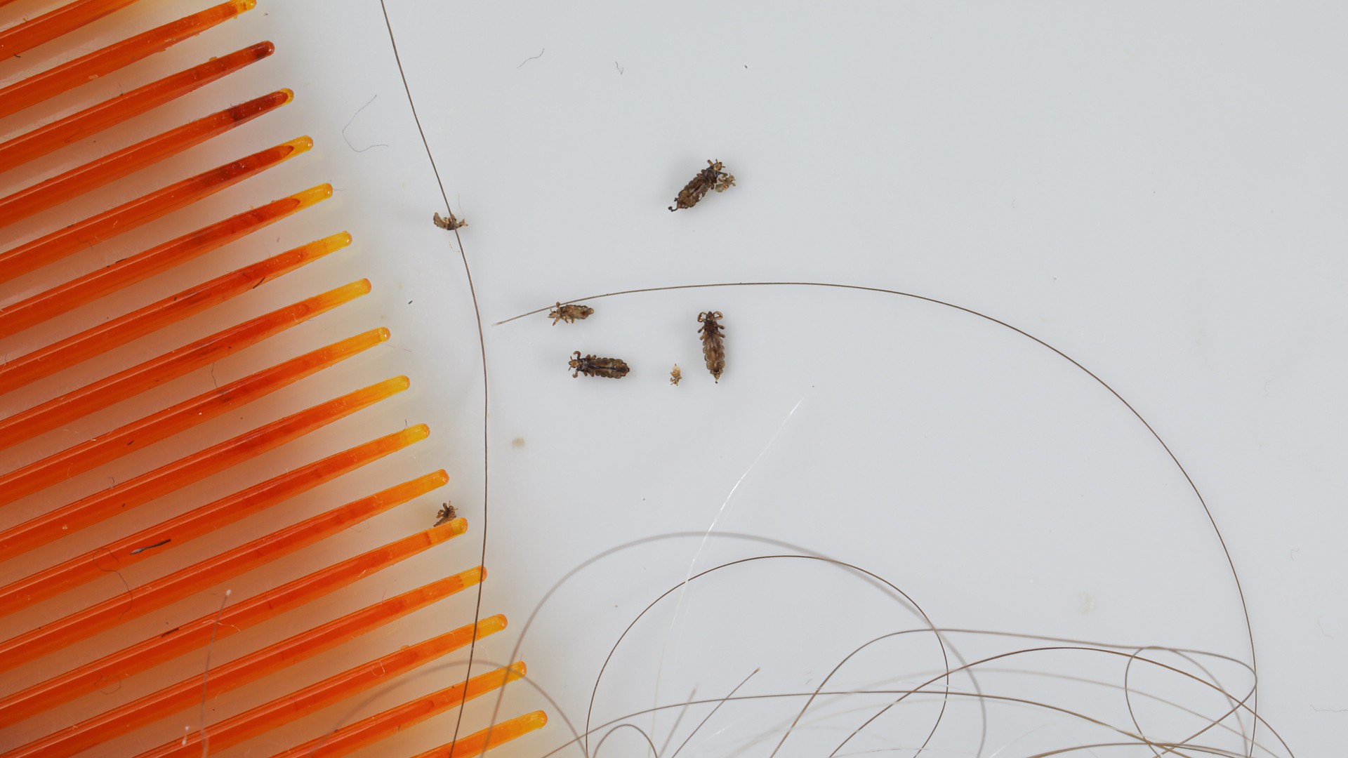 Upgraded: Super Lice: What They Are and How to Treat Them
