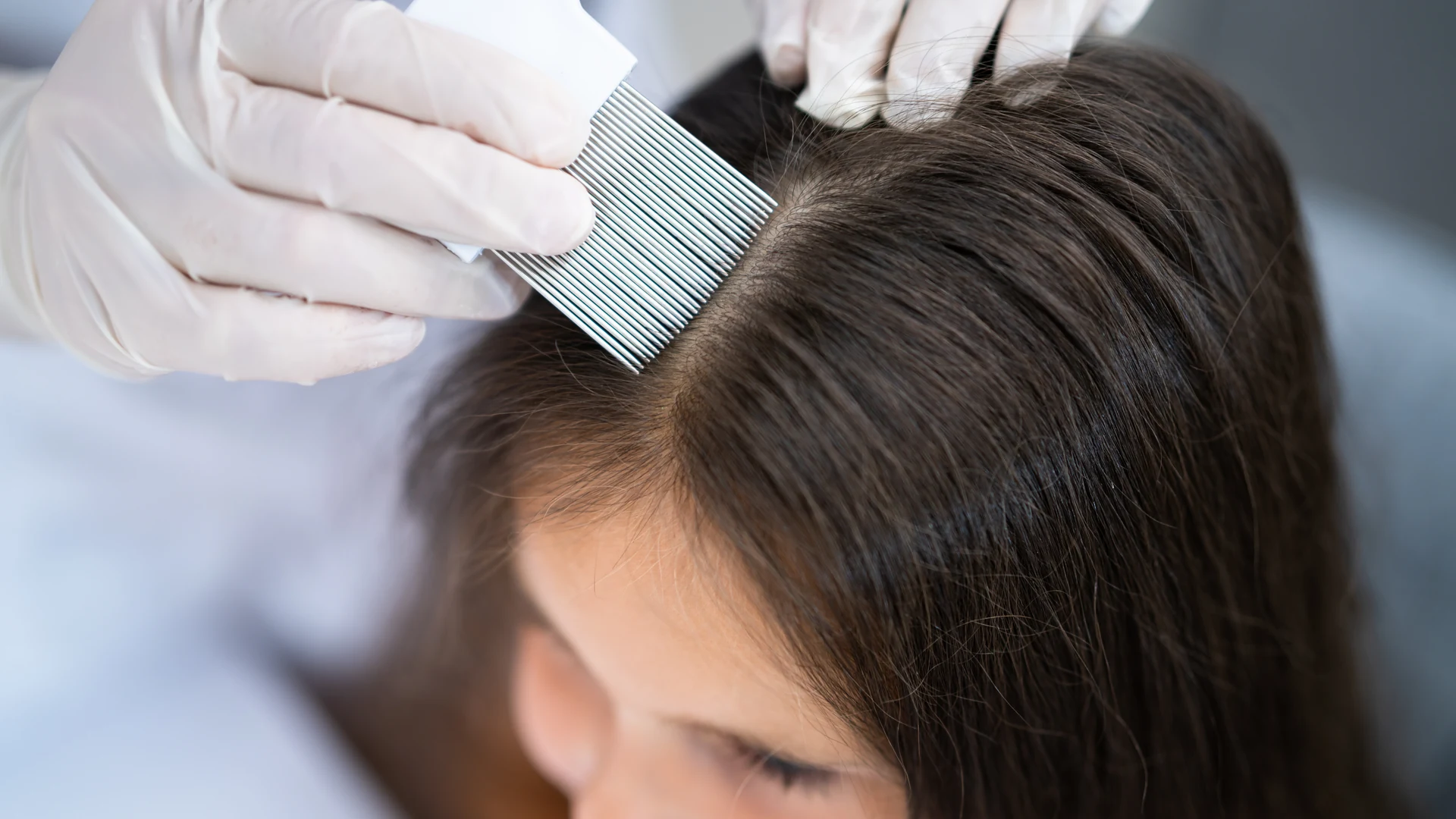 Professional inspecting a child's scalp with a fine-tooth nit comb for lice and nits